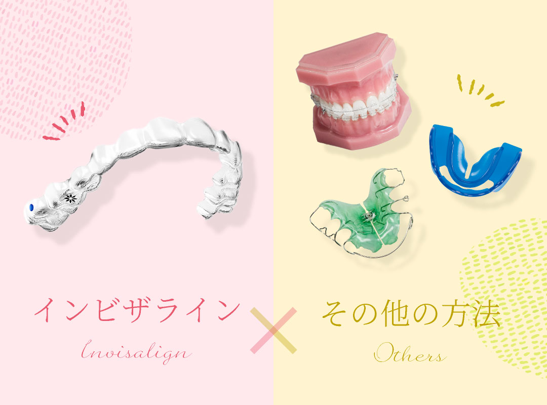 インビザラインまたは、その他の方法