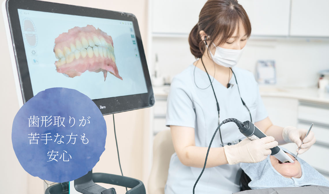 歯形取りが苦手な方も安心